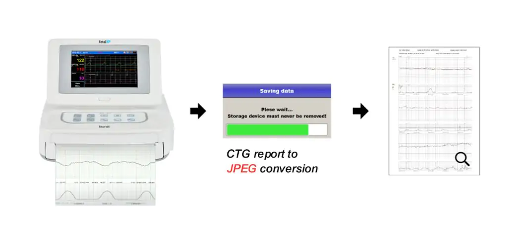 Respbuy-Bionet-FC1400-Fetal Monitor CTG to JPEG Bionet FC1400 Fetal Monitor (CTG Machine)