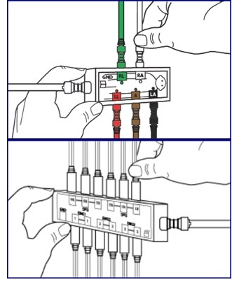 RespBuy-Philips-Alice-PDX-EXG-Yoke-Cable Yoke ExG for Alice PDx - Philips Respironics (ref. 1048415)