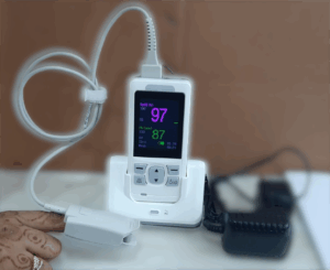 SM80 Handheld SPO2 Monitor